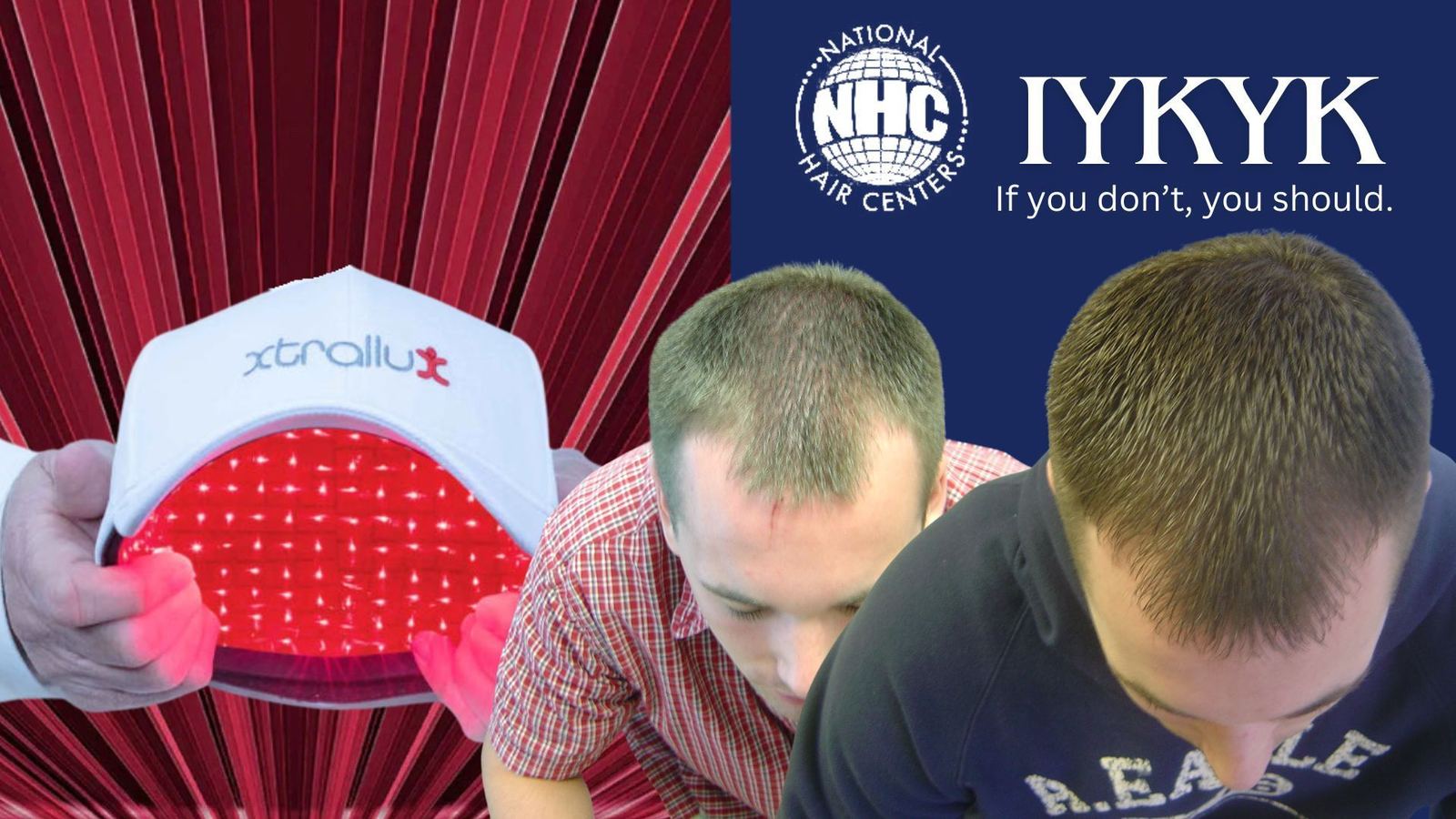 Low-Level Laser Therapy (LLLT) for Hair Regrowth