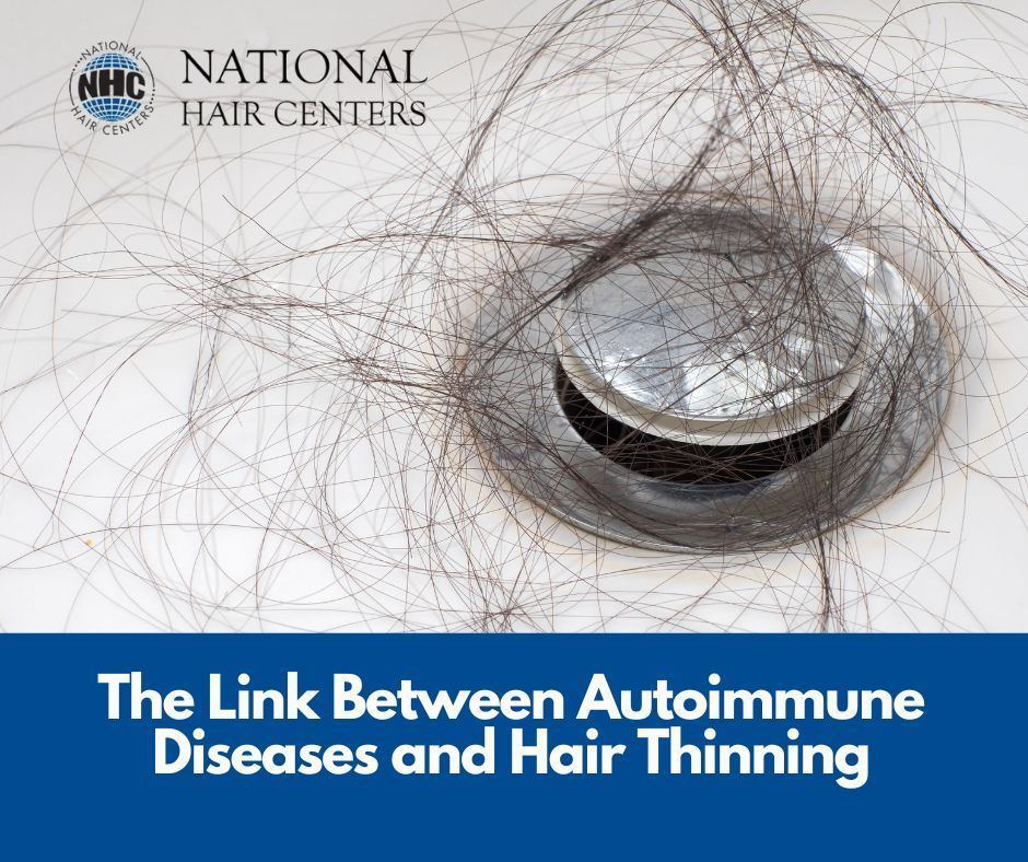 The Link Between Autoimmune Diseases and Hair Thinning