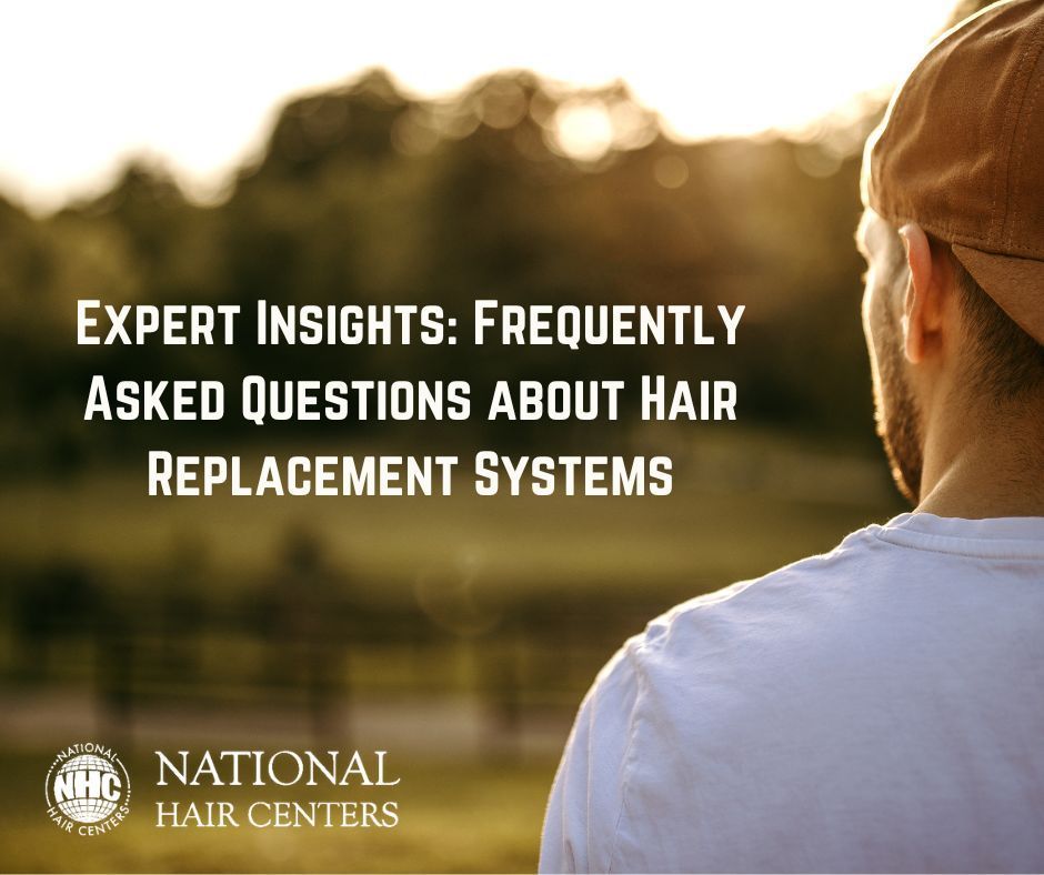 FAQ's About Hair Replacement Systems