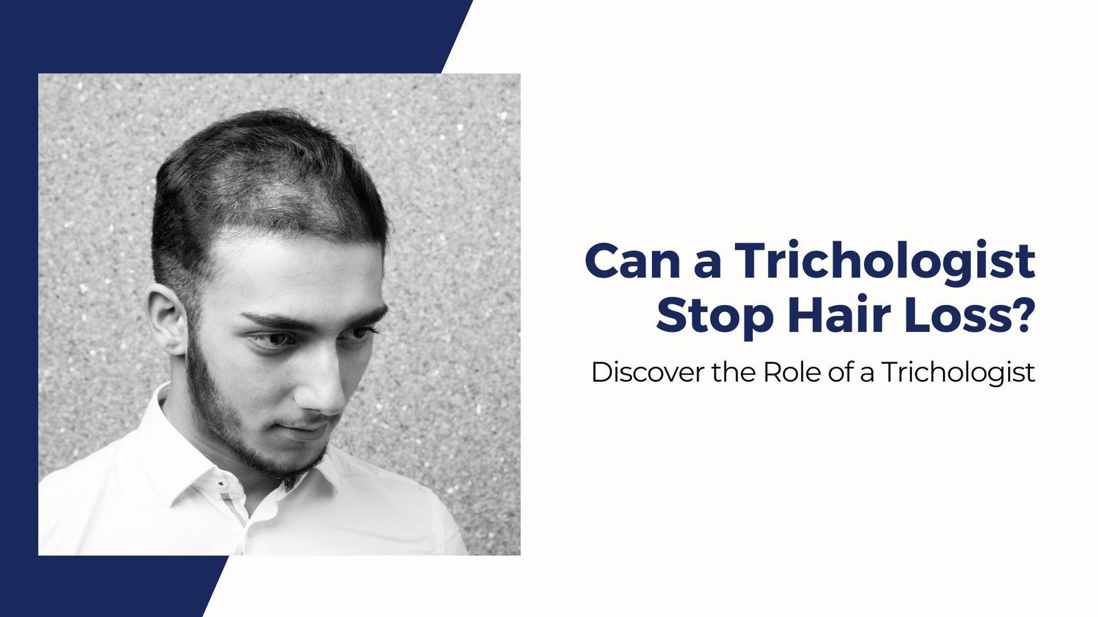 Can a Trichologist Stop Hair Loss? — National Hair Centers