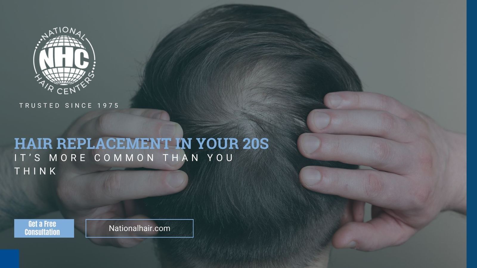 Hair Replacement in Your 20's — National Hair Centers