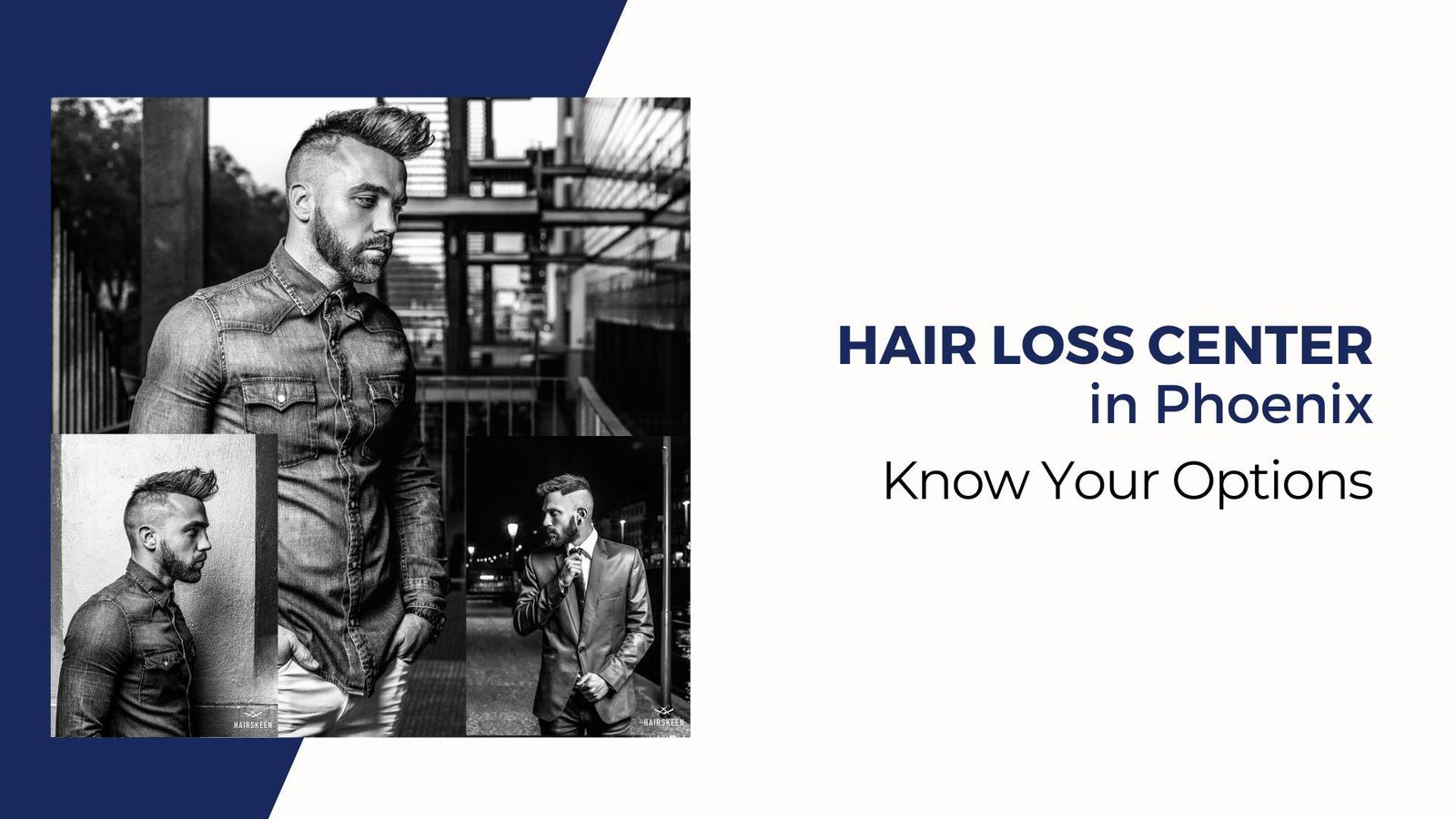 Hair Loss Center in Phoenix: Know Your Options