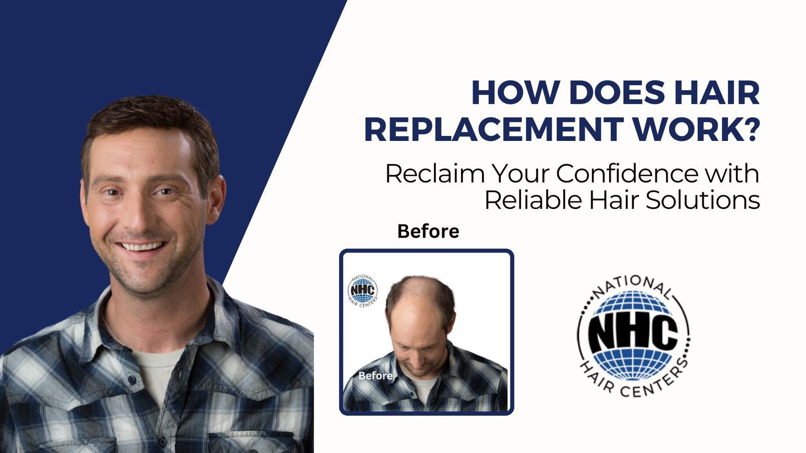 How Does Hair Replacement Work? — National Hair Centers