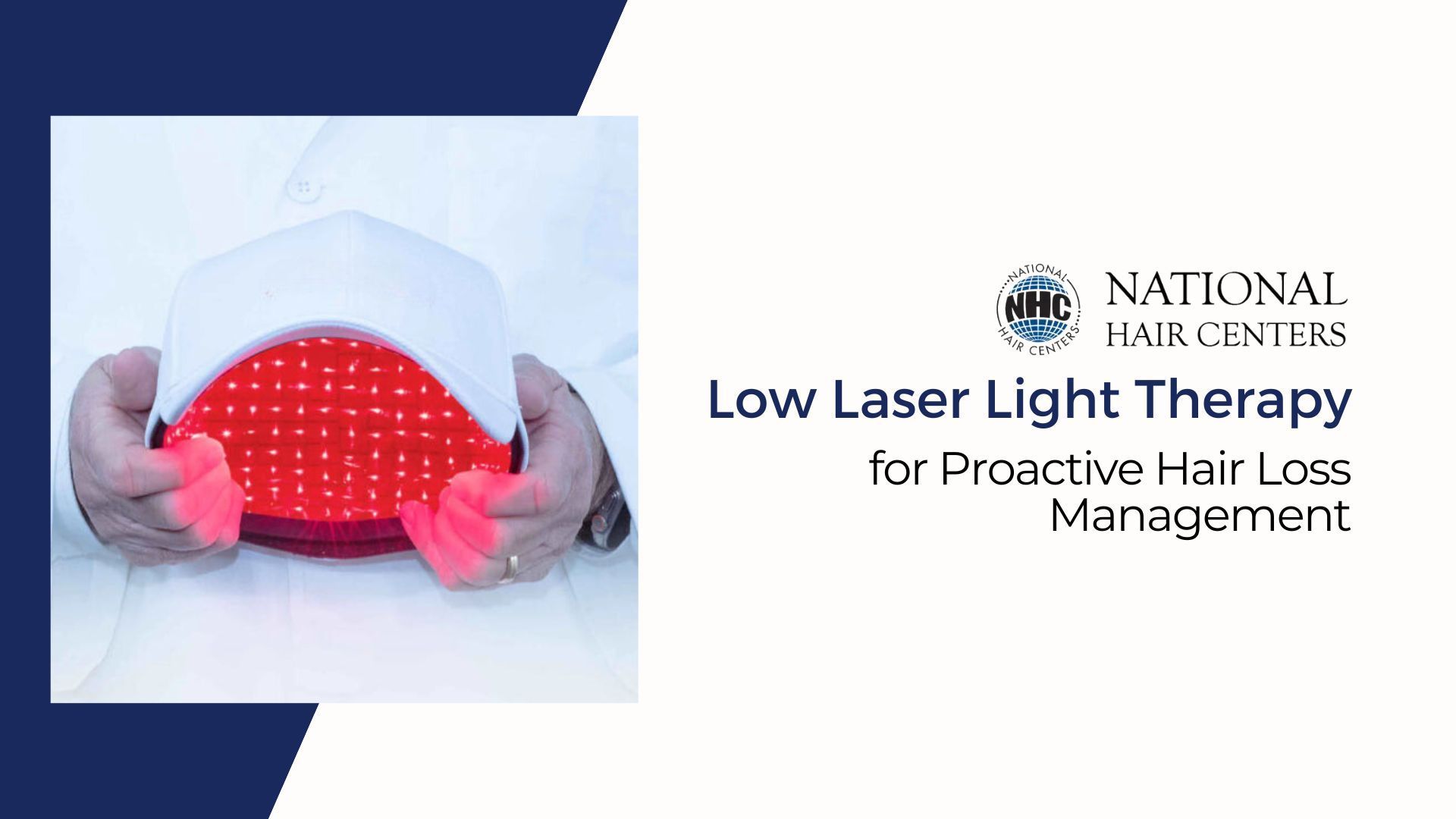 Low Laser Light Therapy for Proactive Hair Loss Management