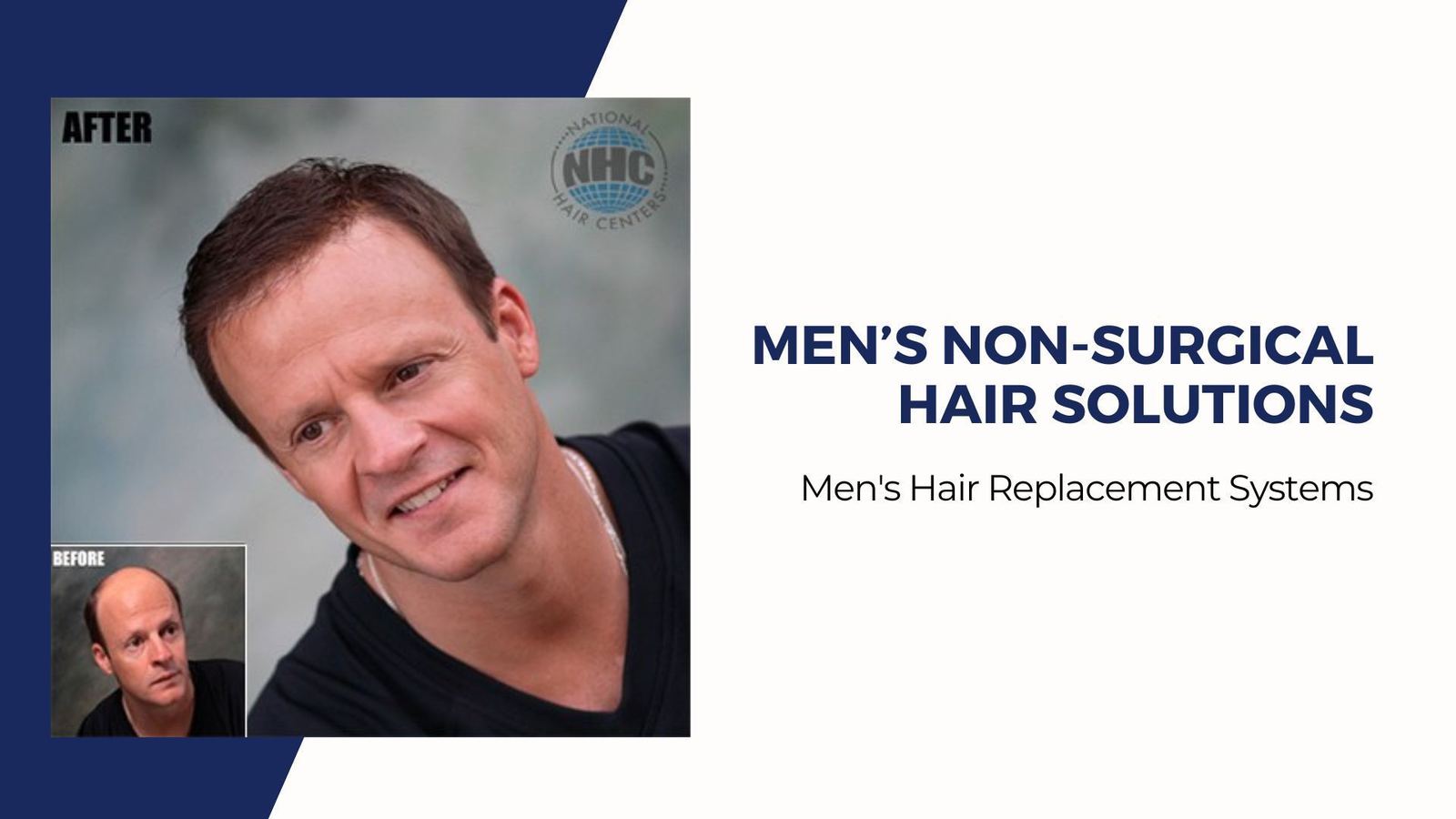 Men’s Non-surgical Hair Solutions — National Hair Centers