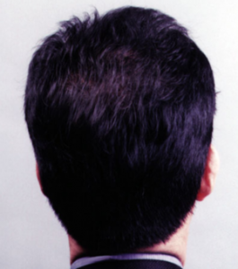 Close-up of Micro Point Links application showing natural hair enhancement