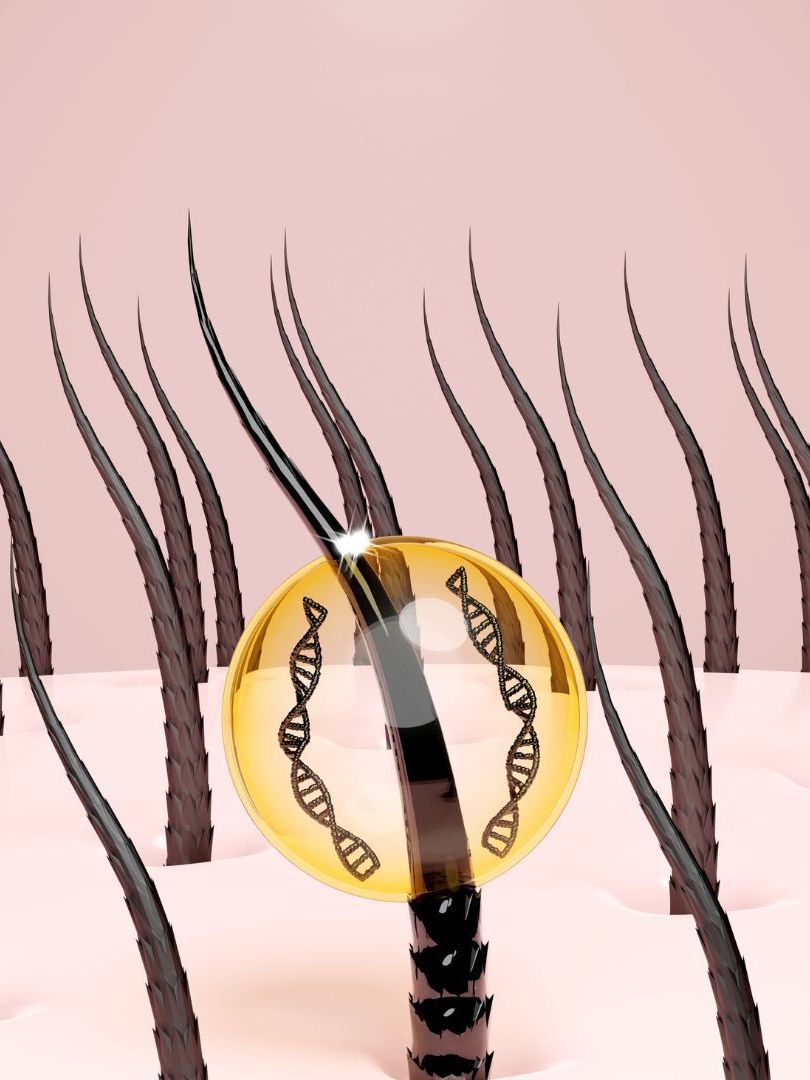 Trichologist performing a scalp analysis at National Hair Centers
