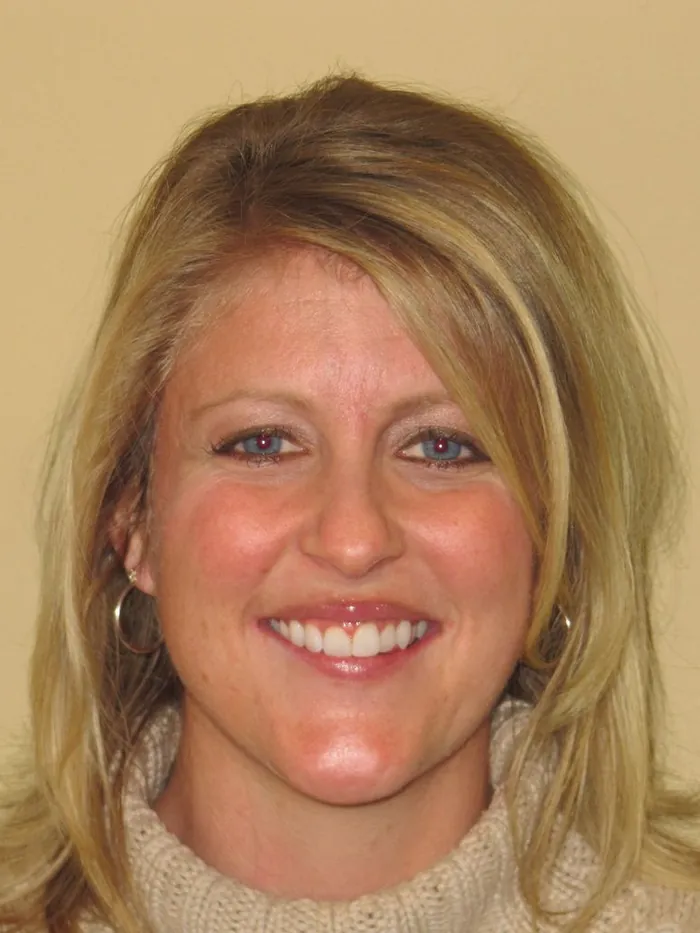 After: full shoulder-length blonde hair with a natural part and no scalp showing