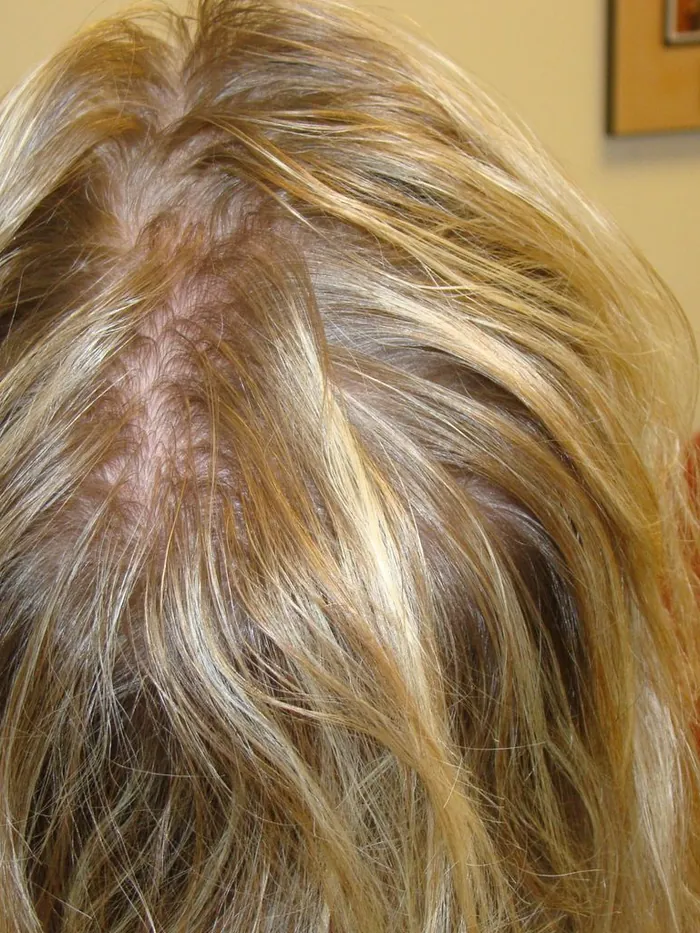 Before: a widened part line photographed from above, with a channel of bare scalp running front to back through blonde hair