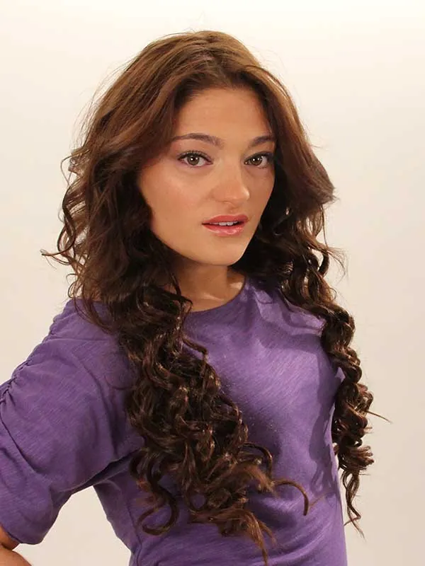 Hair restoration result at National Hair Centers