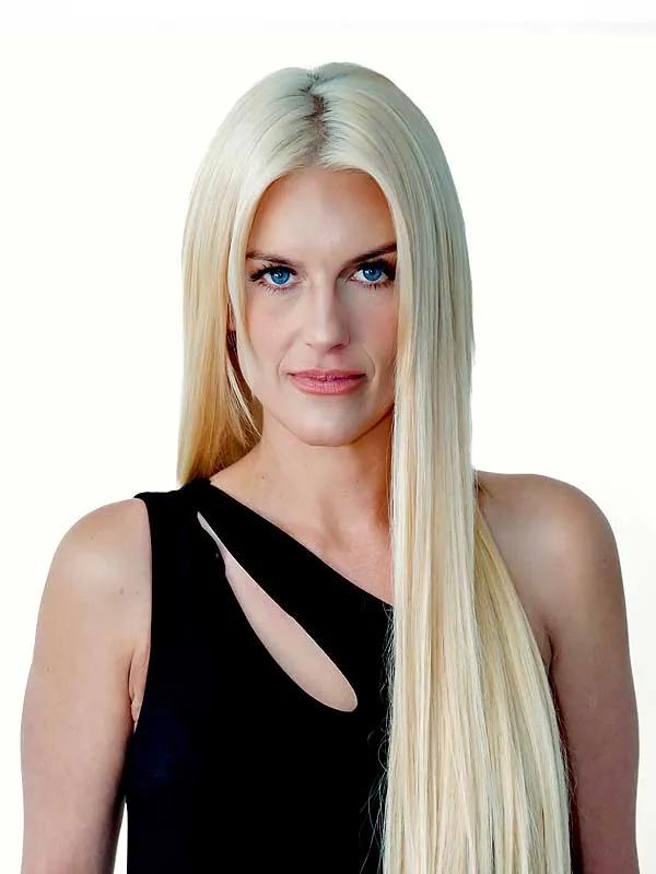 Hair restoration result at National Hair Centers