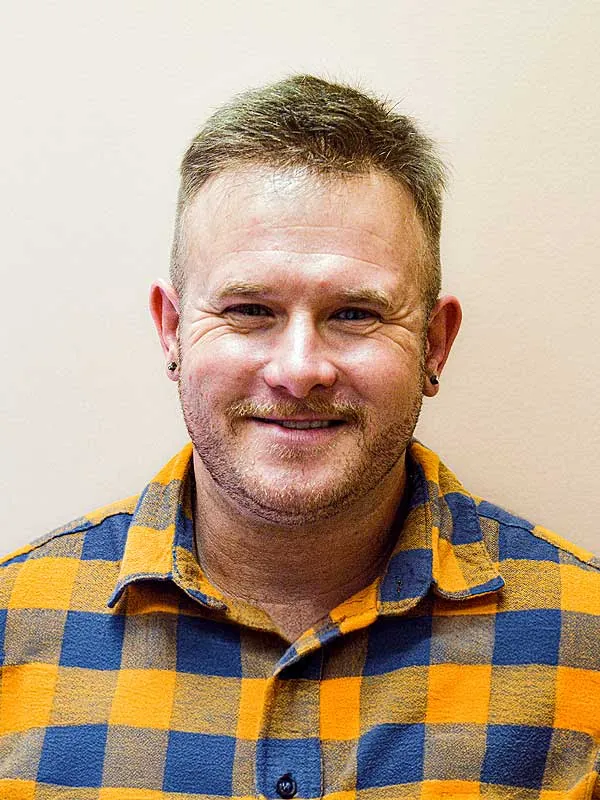 Hair restoration result at National Hair Centers