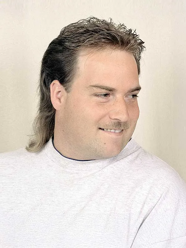 Hair restoration result at National Hair Centers
