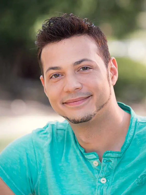 Hair restoration result at National Hair Centers