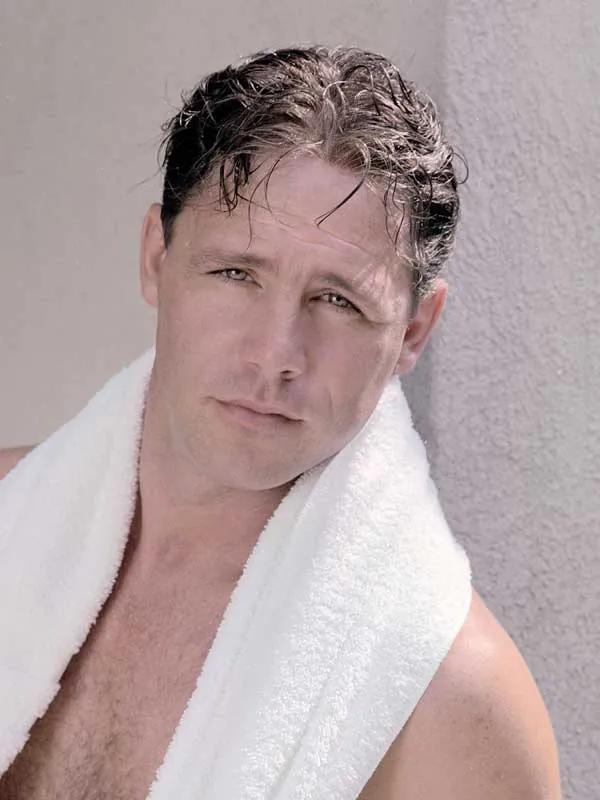 Hair restoration result at National Hair Centers