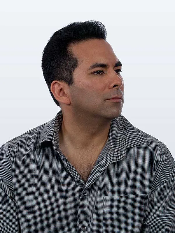 Hair restoration result at National Hair Centers