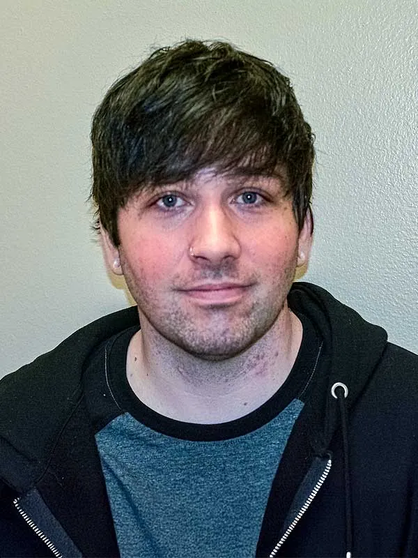 Hair restoration result at National Hair Centers