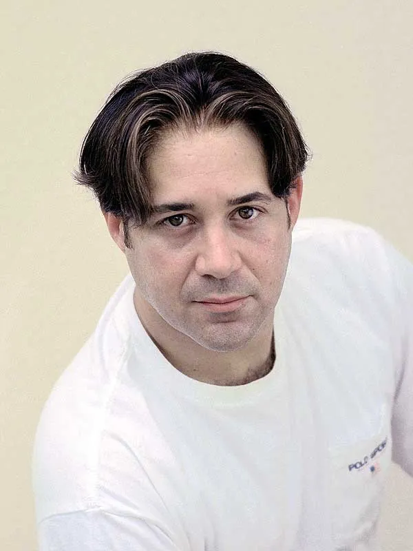 Hair restoration result at National Hair Centers