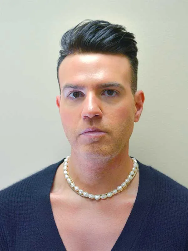 Hair restoration result at National Hair Centers