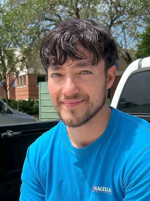 Hair restoration result at National Hair Centers