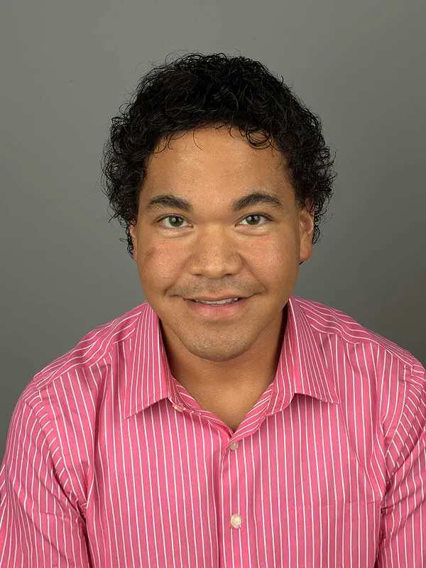 Hair restoration result at National Hair Centers