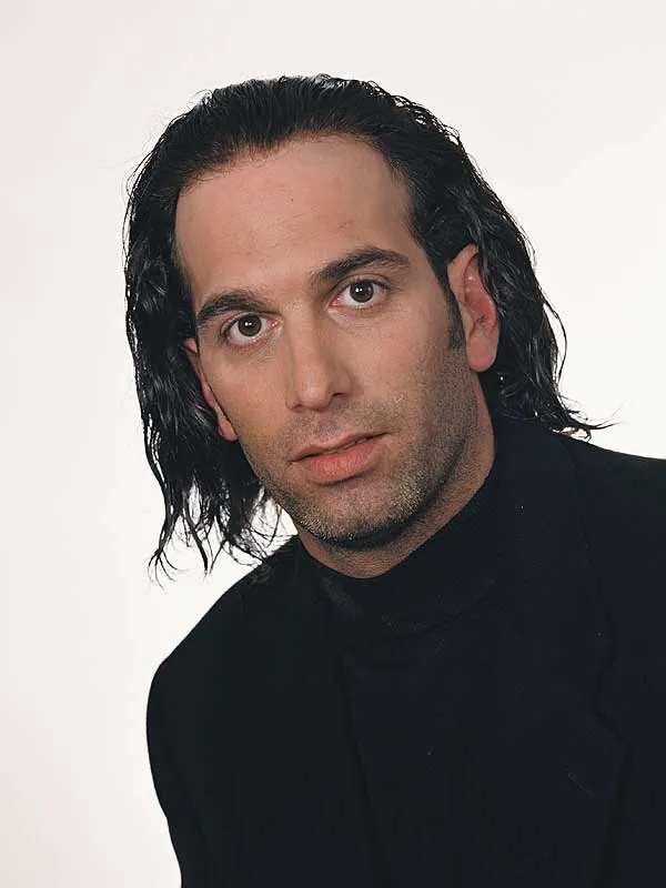 Hair restoration result at National Hair Centers