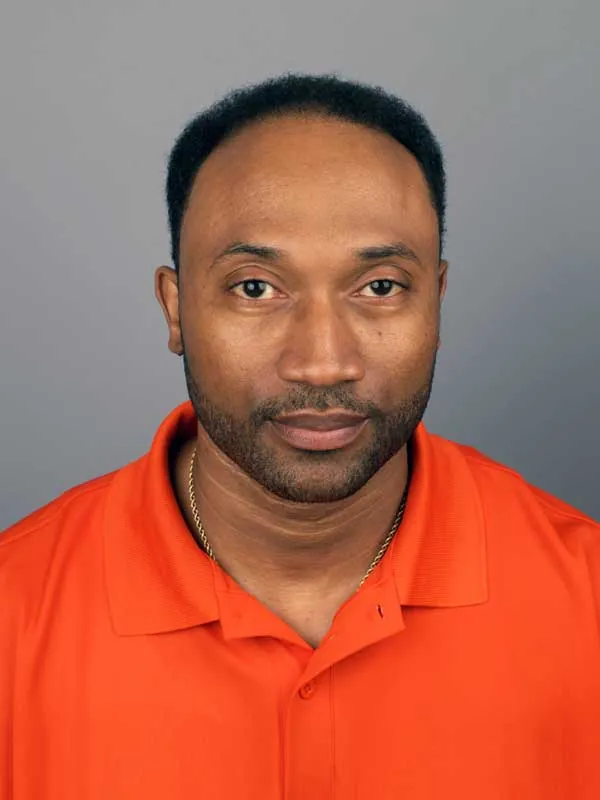 Hair restoration result at National Hair Centers