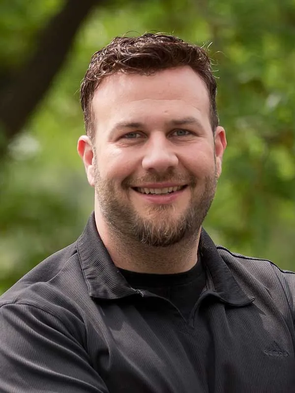 Hair restoration result at National Hair Centers