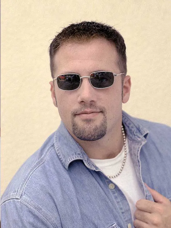 Hair restoration result at National Hair Centers