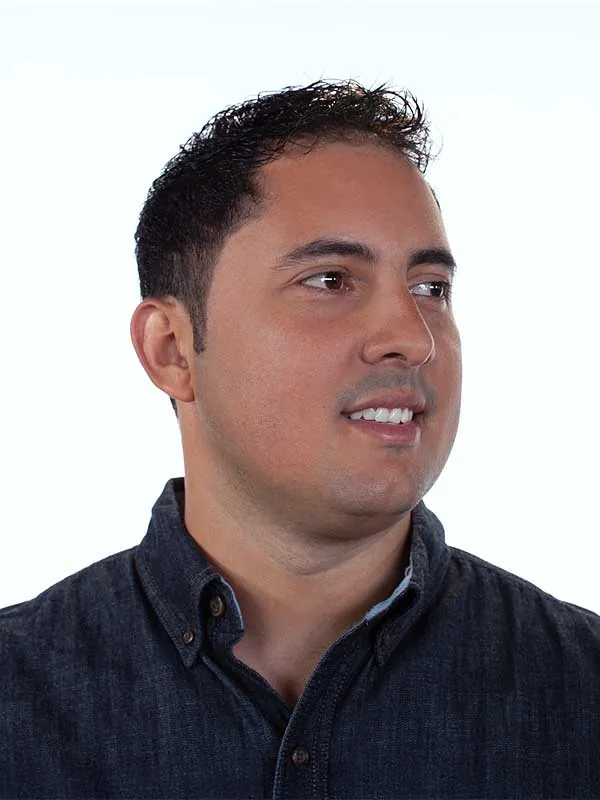 Hair restoration result at National Hair Centers