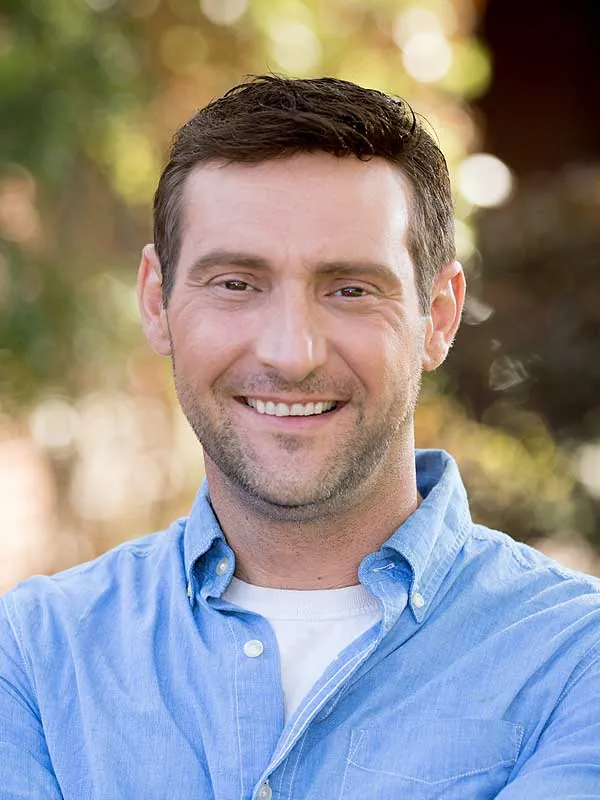 Hair restoration result at National Hair Centers