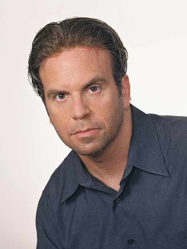 Hair restoration result at National Hair Centers