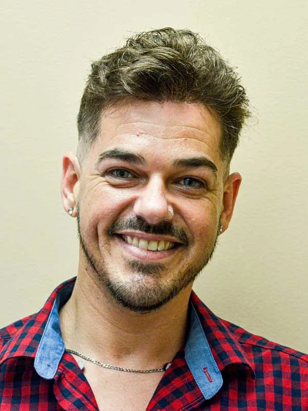 Hair restoration result at National Hair Centers