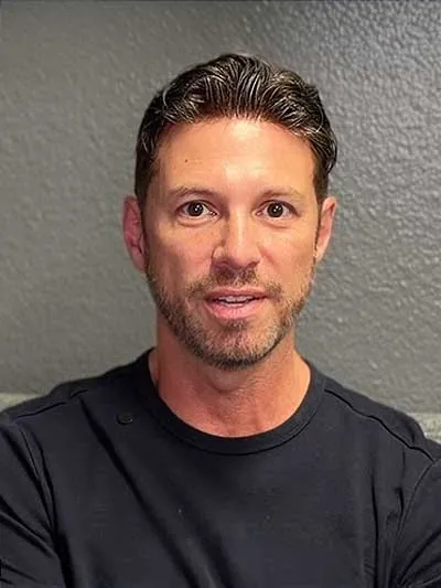 Hair restoration result at National Hair Centers