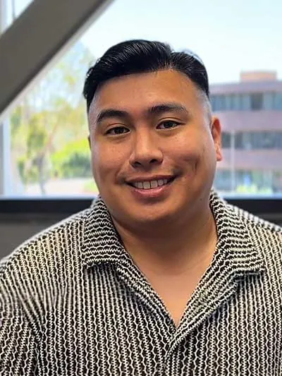 Hair restoration result at National Hair Centers