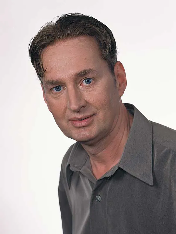Hair restoration result at National Hair Centers