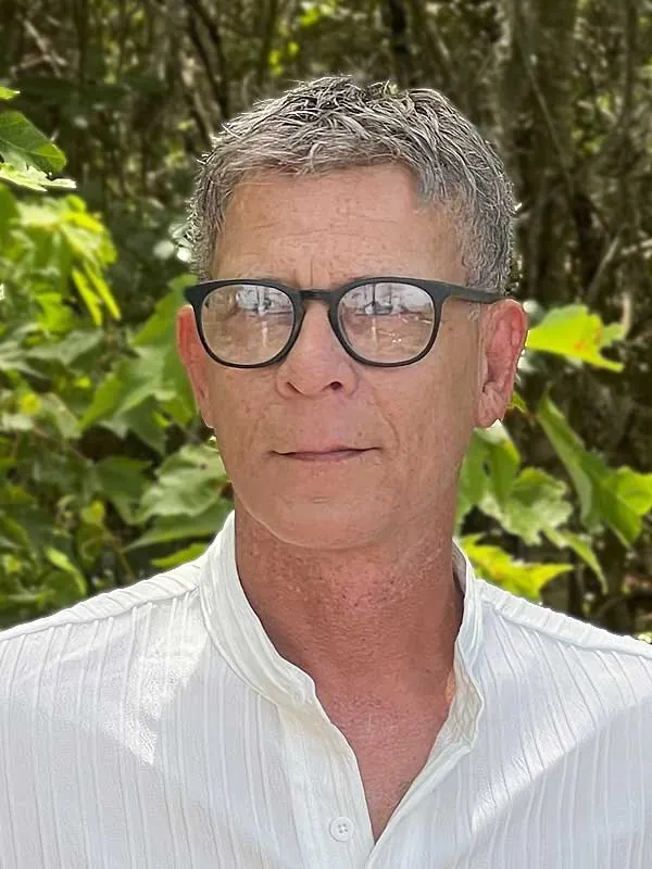 Hair restoration result at National Hair Centers