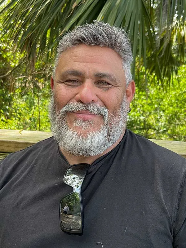 Hair restoration result at National Hair Centers