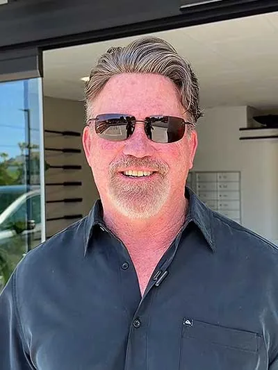 Hair restoration result at National Hair Centers