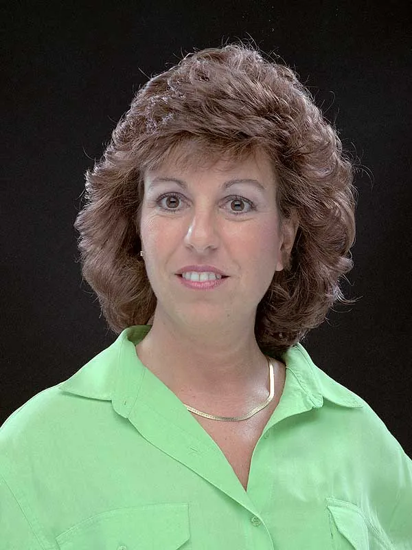 Hair restoration result at National Hair Centers