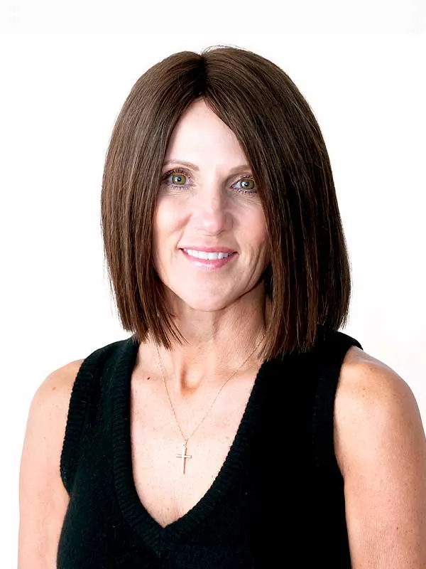 Hair restoration result at National Hair Centers