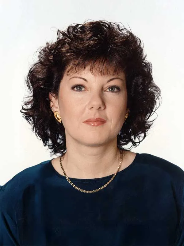 Hair restoration result at National Hair Centers