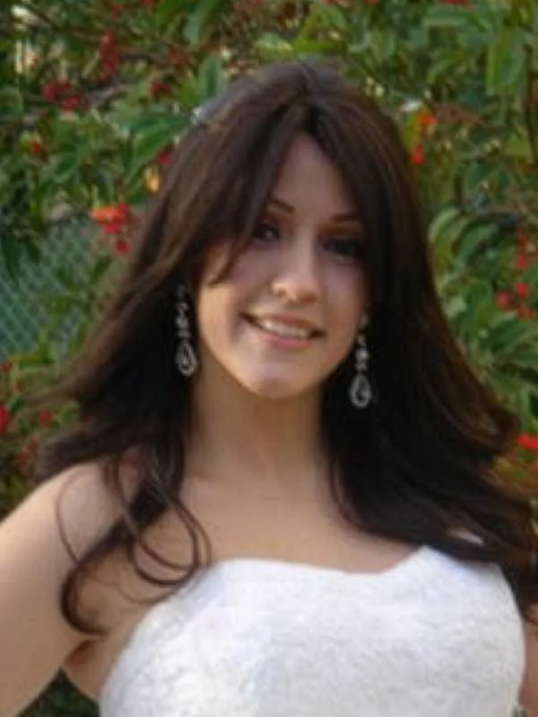 Hair restoration result at National Hair Centers