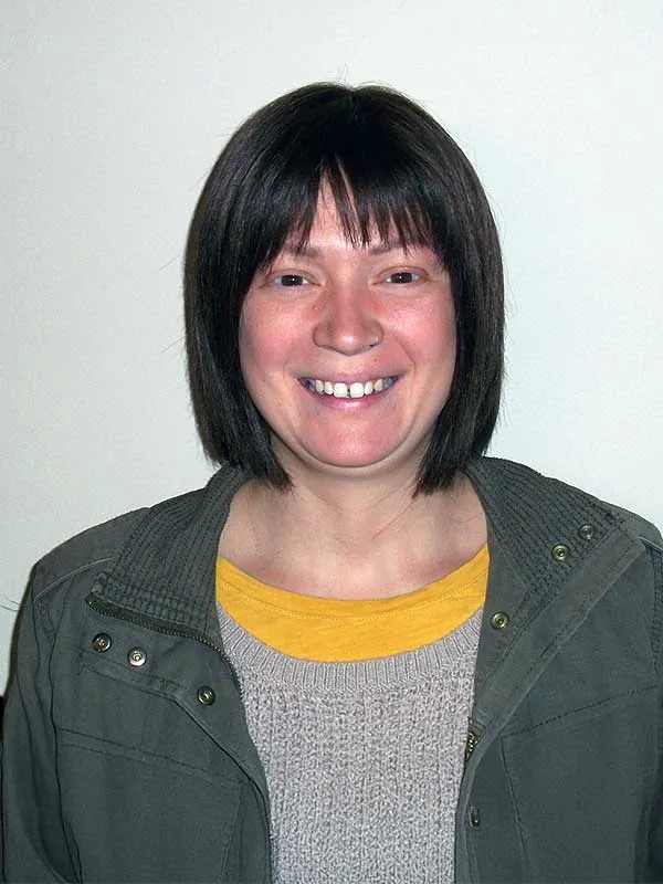 Hair restoration result at National Hair Centers