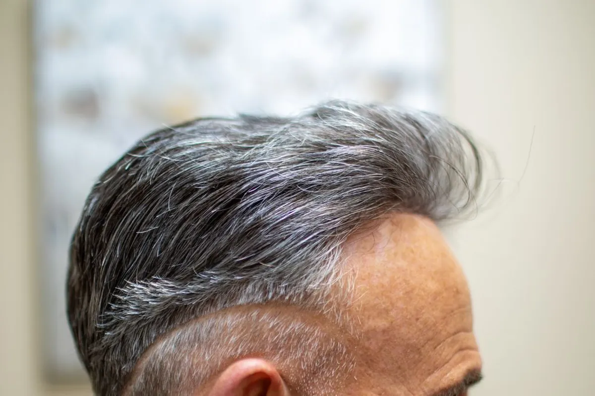 Close-up of a natural front hairline and temple on a salt and pepper hair system, lit from the side