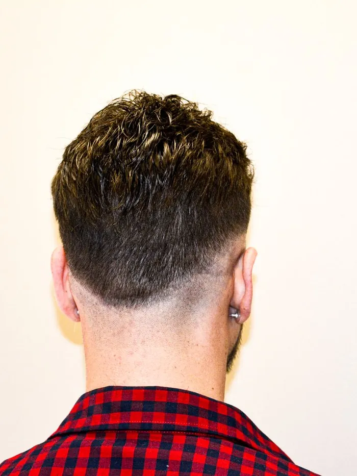 After: full, textured coverage through the crown, same check shirt and same wall