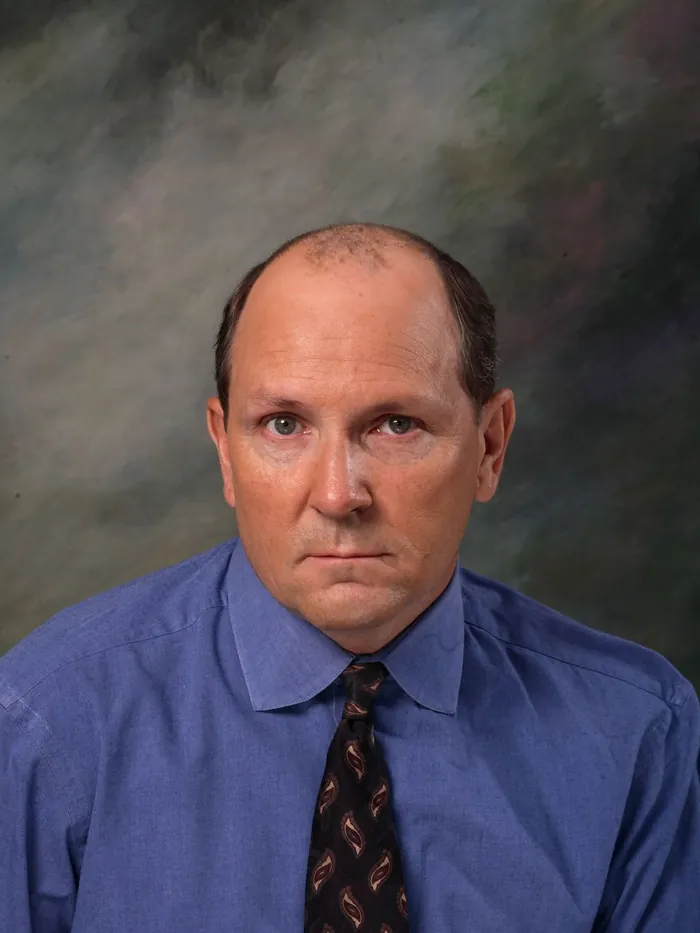 Before: advanced loss across the top with hair left only at the sides, on a painted studio backdrop