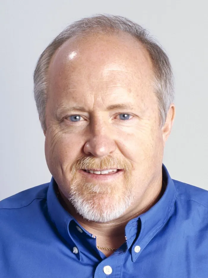 Before: a thinning top and receding front, facing the camera on a light gray backdrop