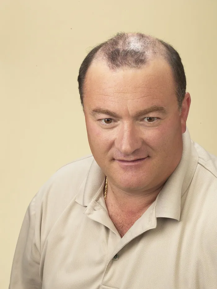 Man in his forties with receding temples and thinning through the middle of the scalp, on a cream studio backdrop