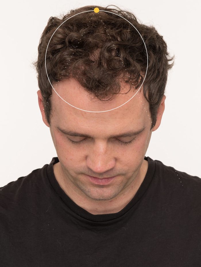 Real Nutrafol client after consistent use — visibly thicker, fuller hair